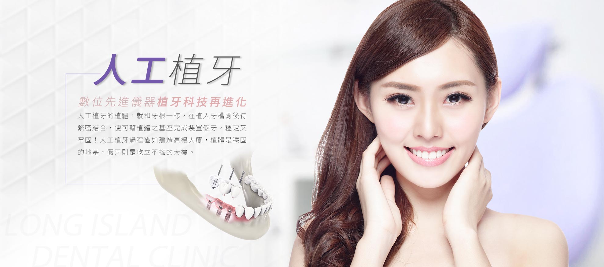 人工植牙