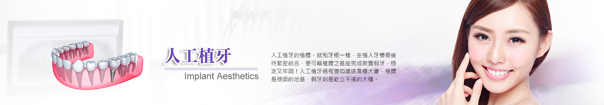 人工植牙 人工植牙