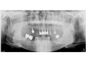 proimages/case/Artificial_implant/all-1.jpg