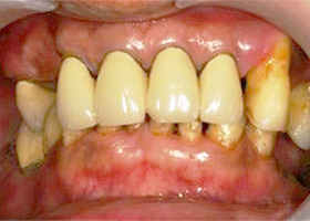proimages/case/Artificial_implant/all-2.jpg