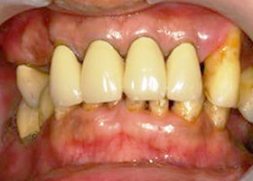 proimages/case/Artificial_implant/all-6.jpg
