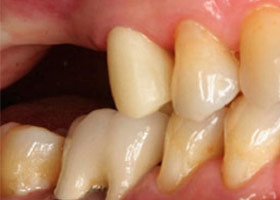 proimages/case/Artificial_implant/topcase01.jpg