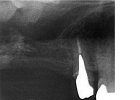 proimages/case/Artificial_implant/topcase02.jpg