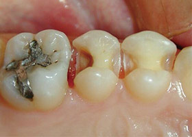 proimages/case/Beauty_Dentistry/201301231418081.jpg
