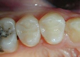 proimages/case/Beauty_Dentistry/201301231418082.jpg