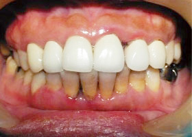 proimages/case/Beauty_Dentistry/beauty01.jpg
