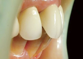 proimages/case/Beauty_Dentistry/beauty03.jpg