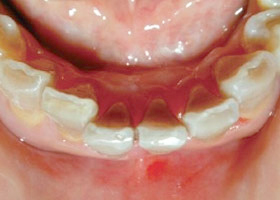 proimages/case/Beauty_Dentistry/beauty04.jpg