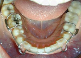 proimages/case/Beauty_Dentistry/beauty08.jpg