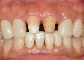 proimages/case/Beauty_Dentistry/beauty09.jpg