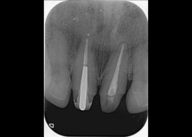proimages/case/Beauty_Dentistry/beauty10.jpg