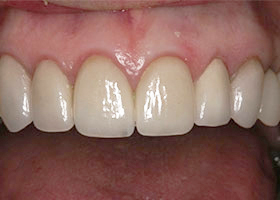 proimages/case/Beauty_Dentistry/beautyteeth-02-3.jpg