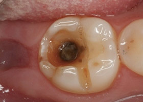 proimages/case/Beauty_Dentistry/pic02.jpg