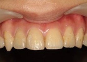 proimages/case/Beauty_Dentistry/white002.jpg