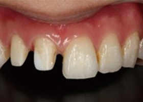 proimages/case/Beauty_Dentistry/white003.jpg
