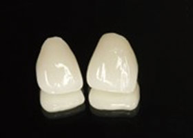 proimages/case/Beauty_Dentistry/white004.jpg