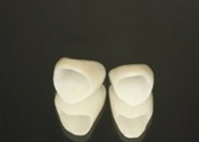 proimages/case/Beauty_Dentistry/white005.jpg