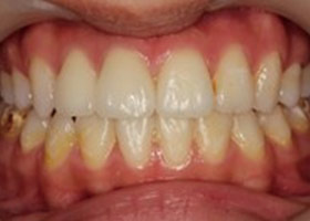 proimages/case/Beauty_Dentistry/white006.jpg