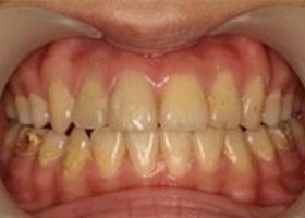 proimages/case/Beauty_Dentistry/white008.jpg
