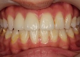 proimages/case/Beauty_Dentistry/white009.jpg