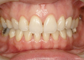 proimages/case/Beauty_Dentistry/white02.jpg proimages/case/Beauty_Dentistry/white02.jpg
