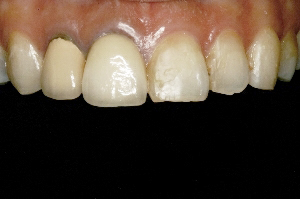 proimages/case/Implant/pic_case-012.jpg