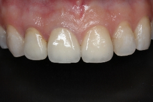 proimages/case/Implant/pic_case-013.jpg