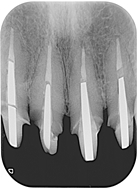 proimages/case/Implant/pic_case-04.JPG