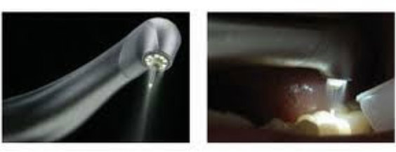 proimages/case/Laser/Laser01.jpg proimages/case/Laser/Laser01.jpg