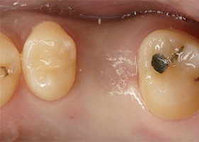proimages/case/Laser/Laser02.jpg proimages/case/Laser/Laser02.jpg