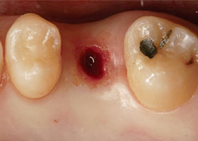 proimages/case/Laser/Laser03-1.jpg proimages/case/Laser/Laser03-1.jpg