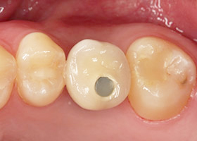 proimages/case/Laser/Laser03-2.jpg proimages/case/Laser/Laser03-2.jpg
