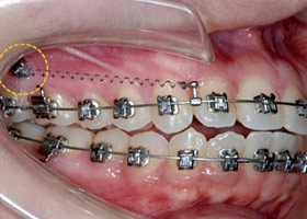 proimages/case/ortho/din01.jpg