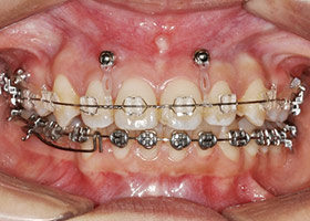 proimages/case/ortho/din02.jpg