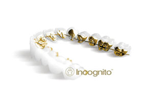 proimages/case/ortho/teeth01.jpg proimages/case/ortho/teeth01.jpg