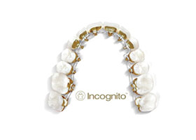 proimages/case/ortho/teeth02.jpg proimages/case/ortho/teeth02.jpg