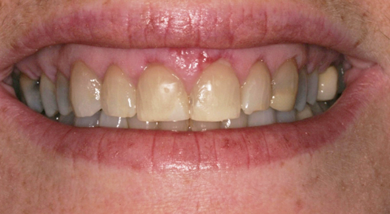 proimages/product/04/pic_product-03.jpg proimages/product/04/pic_product-03.jpg