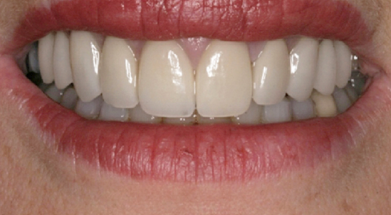 proimages/product/04/pic_product-04.jpg proimages/product/04/pic_product-04.jpg