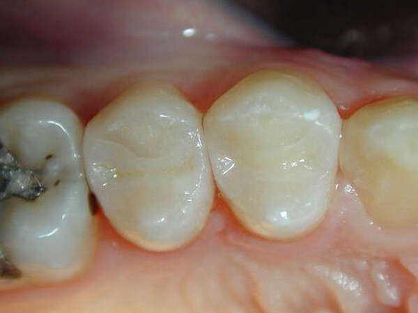 proimages/product/05/pic_product-02.jpg proimages/product/05/pic_product-02.jpg